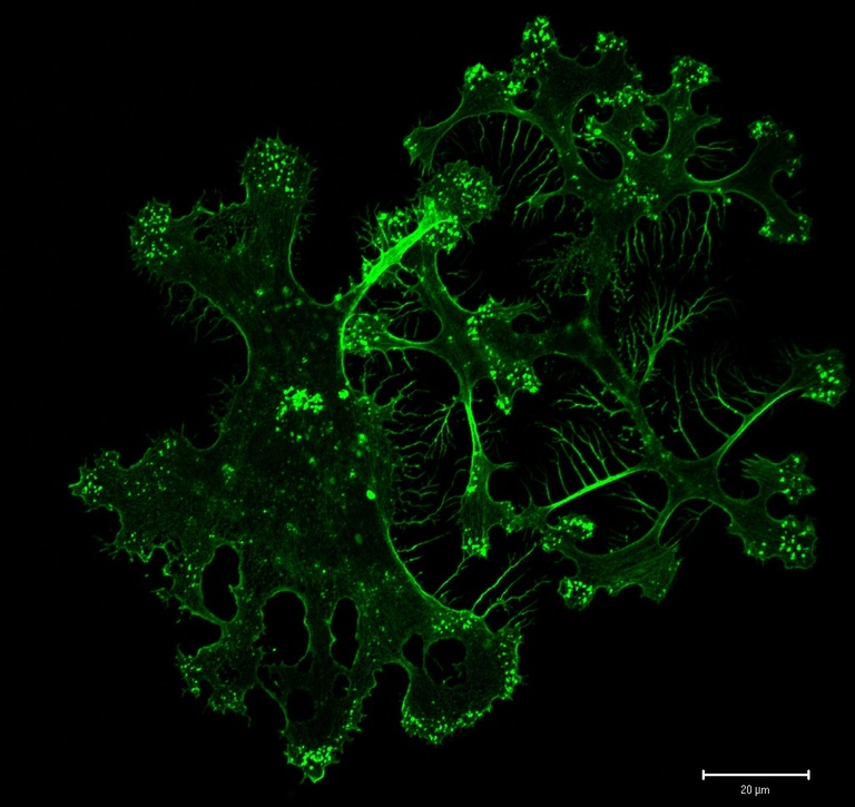 Primary human dendritic cell captured by Karla Daniels